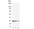 TNF Receptor Superfamily Member 1A antibody, R30488, NSJ Bioreagents, Western Blot image 