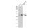 Glucosylceramidase Beta antibody, GTX114073, GeneTex, Western Blot image 