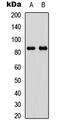 Gys3 antibody, abx121491, Abbexa, Western Blot image 