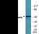 Interleukin 7 Receptor antibody, EKC2300, Boster Biological Technology, Western Blot image 