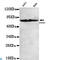 Forkhead Box O1 antibody, LS-C812970, Lifespan Biosciences, Western Blot image 