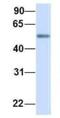 Malic enzyme 2 antibody, NBP1-54765, Novus Biologicals, Western Blot image 