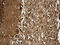 Karyopherin Subunit Beta 1 antibody, M01851, Boster Biological Technology, Immunohistochemistry paraffin image 