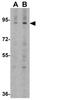 Amyloid Beta Precursor Protein Binding Family A Member 1 antibody, GTX17173, GeneTex, Western Blot image 