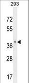 Olfactory Receptor Family 8 Subfamily B Member 8 antibody, LS-C163254, Lifespan Biosciences, Western Blot image 