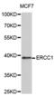 ERCC Excision Repair 1, Endonuclease Non-Catalytic Subunit antibody, abx000856, Abbexa, Western Blot image 