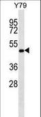 Zinc finger FYVE domain-containing protein 19 antibody, LS-C160787, Lifespan Biosciences, Western Blot image 