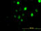 Polo Like Kinase 1 antibody, LS-C197924, Lifespan Biosciences, Immunofluorescence image 