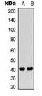 F2R Like Thrombin Or Trypsin Receptor 3 antibody, LS-C358979, Lifespan Biosciences, Western Blot image 