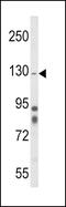 Integrin Subunit Alpha 1 antibody, 63-654, ProSci, Western Blot image 