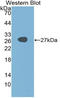 Quiescin Sulfhydryl Oxidase 1 antibody, LS-C314501, Lifespan Biosciences, Western Blot image 