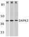 Death Associated Protein Kinase 2 antibody, GTX28404, GeneTex, Western Blot image 