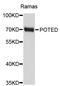 POTE Ankyrin Domain Family Member D antibody, STJ26464, St John
