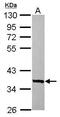 TMEM66 antibody, PA5-31588, Invitrogen Antibodies, Western Blot image 