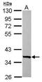 Store-Operated Calcium Entry Associated Regulatory Factor antibody, PA5-31588, Invitrogen Antibodies, Western Blot image 