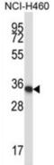 Homeobox A11 antibody, abx027954, Abbexa, Western Blot image 