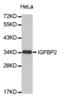 Insulin Like Growth Factor Binding Protein 2 antibody, abx000709, Abbexa, Western Blot image 