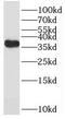 Tetrapeptide Repeat Homeobox 1 antibody, FNab08902, FineTest, Western Blot image 