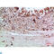 Thyroglobulin antibody, LS-C813944, Lifespan Biosciences, Immunohistochemistry paraffin image 