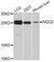 N-Ribosyldihydronicotinamide:Quinone Reductase 2 antibody, LS-C747113, Lifespan Biosciences, Western Blot image 