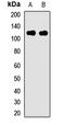 Progesterone Immunomodulatory Binding Factor 1 antibody, LS-C668708, Lifespan Biosciences, Western Blot image 