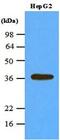 Protein Phosphatase 1 Catalytic Subunit Alpha antibody, MBS200069, MyBioSource, Western Blot image 