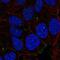 Nance-Horan syndrome protein antibody, NBP2-56313, Novus Biologicals, Immunocytochemistry image 