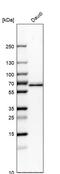 Malic Enzyme 2 antibody, PA5-52621, Invitrogen Antibodies, Western Blot image 