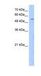 Limb Development Membrane Protein 1 antibody, NBP1-60037, Novus Biologicals, Western Blot image 