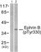 EPH Receptor B1 antibody, PA5-38066, Invitrogen Antibodies, Western Blot image 
