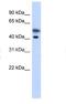 Tropomodulin 2 antibody, NBP1-79572, Novus Biologicals, Western Blot image 