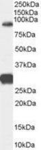 Forkhead Box P2 antibody, GTX89199, GeneTex, Western Blot image 