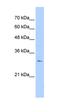 Rhomboid Like 2 antibody, orb325336, Biorbyt, Western Blot image 