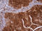 Isocitrate Dehydrogenase (NADP(+)) 1, Cytosolic antibody, LS-C175286, Lifespan Biosciences, Immunohistochemistry frozen image 