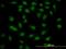 Mediator Complex Subunit 21 antibody, H00009412-M10, Novus Biologicals, Immunocytochemistry image 