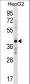 AE Binding Protein 2 antibody, LS-C161015, Lifespan Biosciences, Western Blot image 