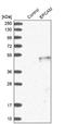 Epithelial Cell Adhesion Molecule antibody, NBP1-89404, Novus Biologicals, Western Blot image 