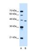 Solute Carrier Family 16 Member 12 antibody, NBP1-59530, Novus Biologicals, Western Blot image 