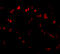 Sprouty Related EVH1 Domain Containing 1 antibody, 4843, ProSci, Immunofluorescence image 