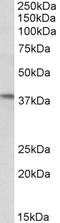 Interferon-inducible protein AIM2 antibody, LS-C204963, Lifespan Biosciences, Western Blot image 