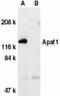 Apoptotic Peptidase Activating Factor 1 antibody, GTX22000, GeneTex, Western Blot image 