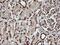 Protein Tyrosine Kinase 2 antibody, NBP2-45923, Novus Biologicals, Immunohistochemistry paraffin image 