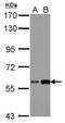 Dyskerin Pseudouridine Synthase 1 antibody, GTX109000, GeneTex, Western Blot image 