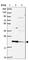 Transmembrane Protein 11 antibody, HPA051795, Atlas Antibodies, Western Blot image 