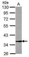 Zinc Finger Protein 396 antibody, PA5-30926, Invitrogen Antibodies, Western Blot image 