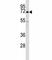 Bruton Tyrosine Kinase antibody, F43054-0.4ML, NSJ Bioreagents, Western Blot image 