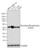 Thymidine Phosphorylase antibody, MA5-13542, Invitrogen Antibodies, Western Blot image 