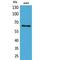 Keratin 2 antibody, LS-C387085, Lifespan Biosciences, Western Blot image 