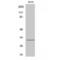 Iodothyronine Deiodinase 3 antibody, LS-C383145, Lifespan Biosciences, Western Blot image 