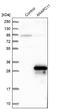 Anaphase Promoting Complex Subunit 11 antibody, NBP1-90139, Novus Biologicals, Western Blot image 